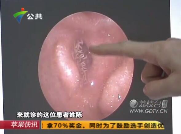 @֣Ӷ(ni)LMɫx˺ҧʹ