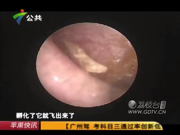 @֣Ӷ(ni)LMɫx˺ҧʹ