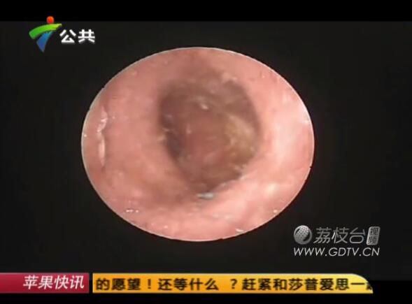 @֣Ӷ(ni)LMɫx˺ҧʹ