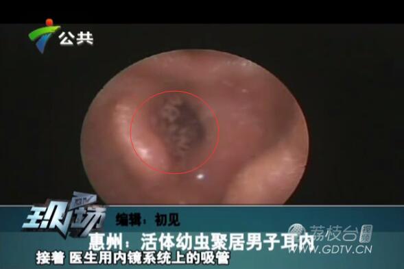 @֣Ӷ(ni)LMɫx˺ҧʹ