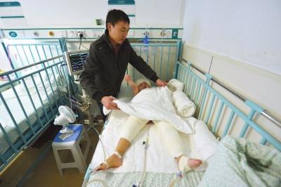 河北3歲女童掉進(jìn)開水鍋 3次植皮手術(shù)花光積蓄