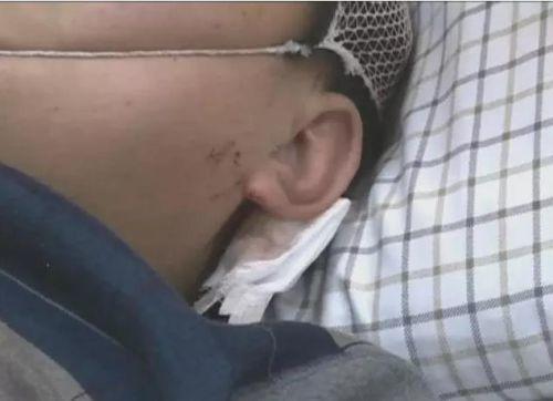 һ𱻴߀߅ϵܴ硣(jng)^(gu)t(y)Дܴ~ƤܛM[ÛһֱڻԠB(ti)Ŀǰ߀](mi)ж^(gu)ΣU(xin)ڡ